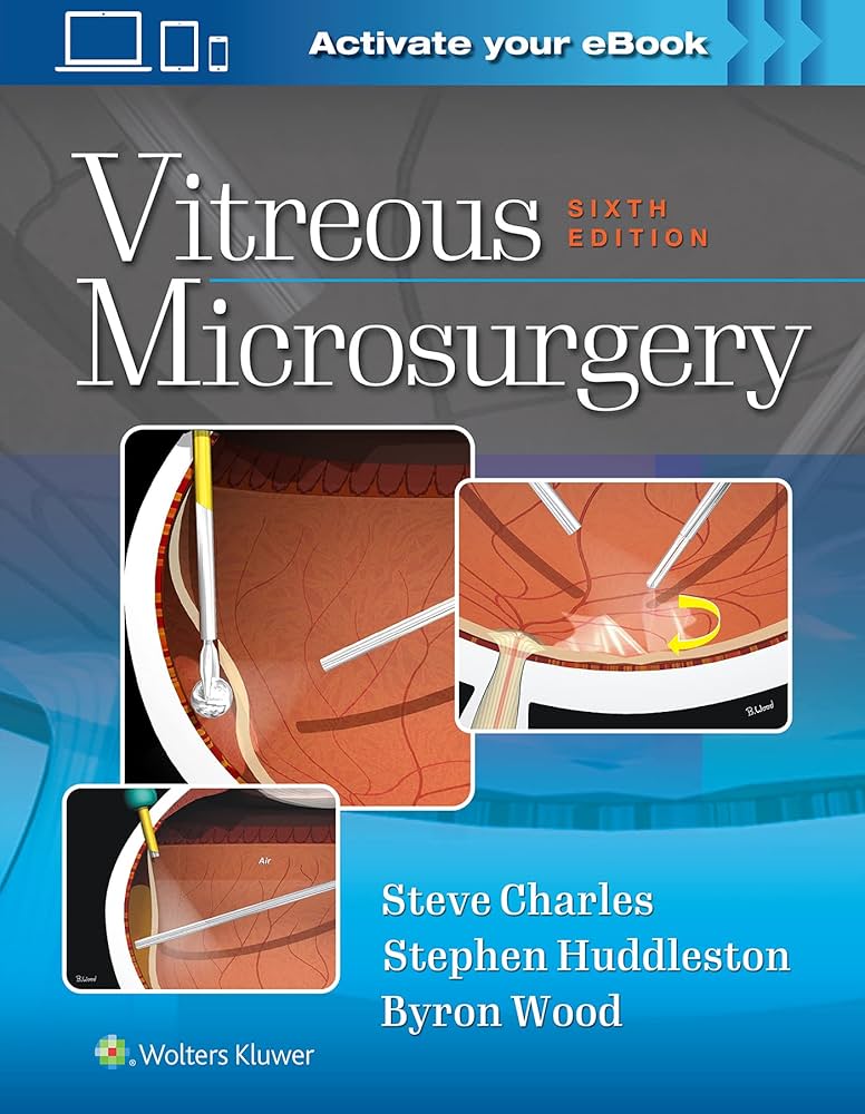 Vitreous Microsurgery: 9781975168353: Medicine & Health Science