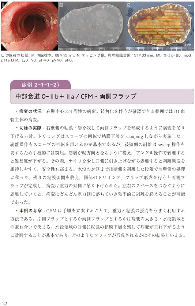 新版ESDアトラス 総論・食道・胃 編[Web動画付] | 豊永 高史 |本