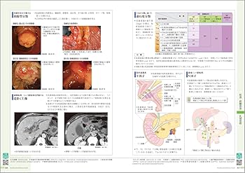 病気がみえるvol.1 消化器 第7版 | 医療情報科学研究所 |本 | 通販