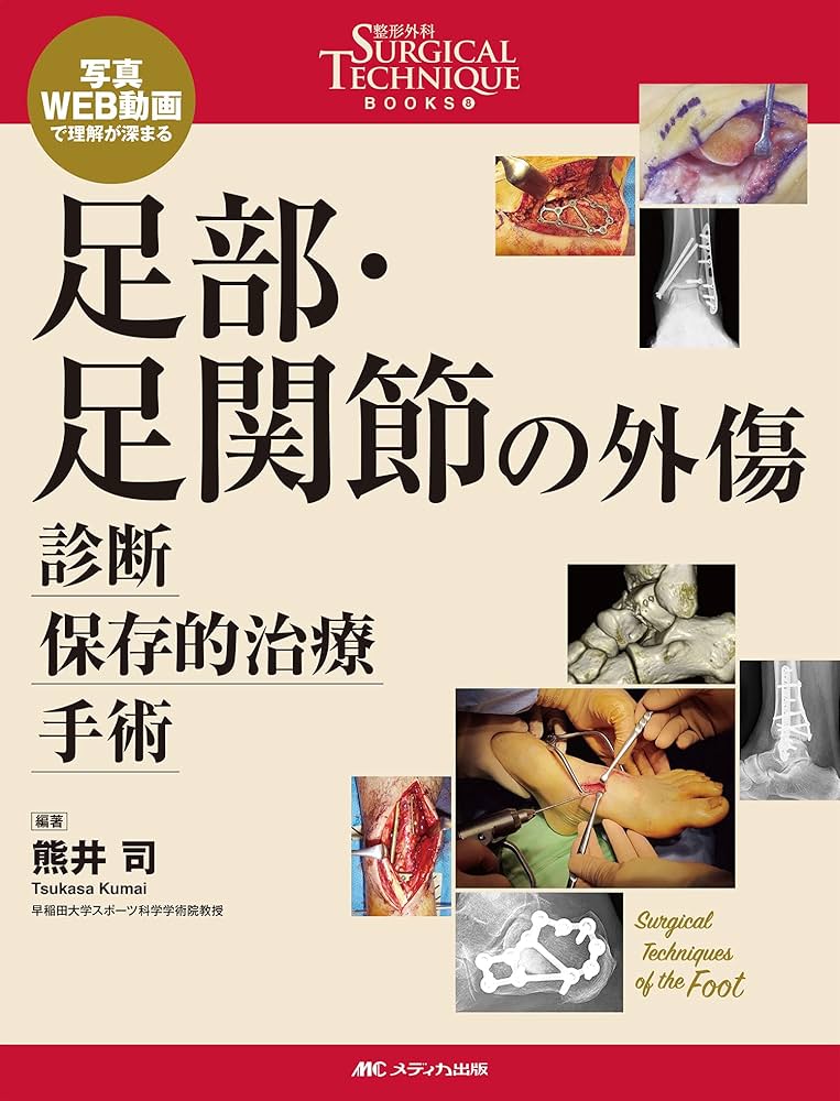 足部・足関節の外傷 診断・保存的治療・手術: 写真・WEB動画で理解が