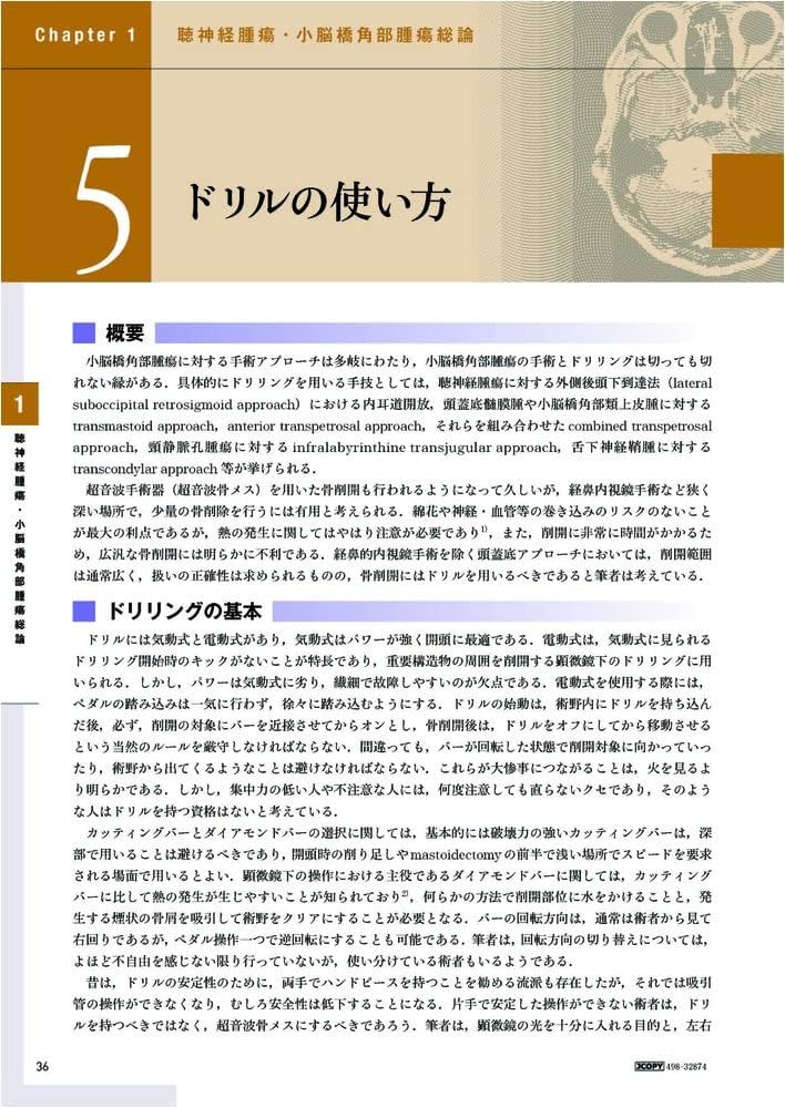 聴神経腫瘍・小脳橋角部腫瘍の手術とマネージメント | 河野 道宏 |本