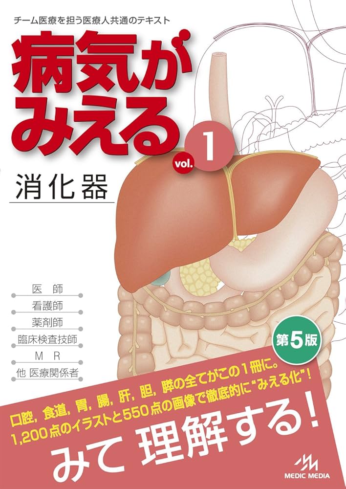 病気がみえる 〈vol.1〉 消化器 | 医療情報科学研究所 |本 | 通販 | Amazon