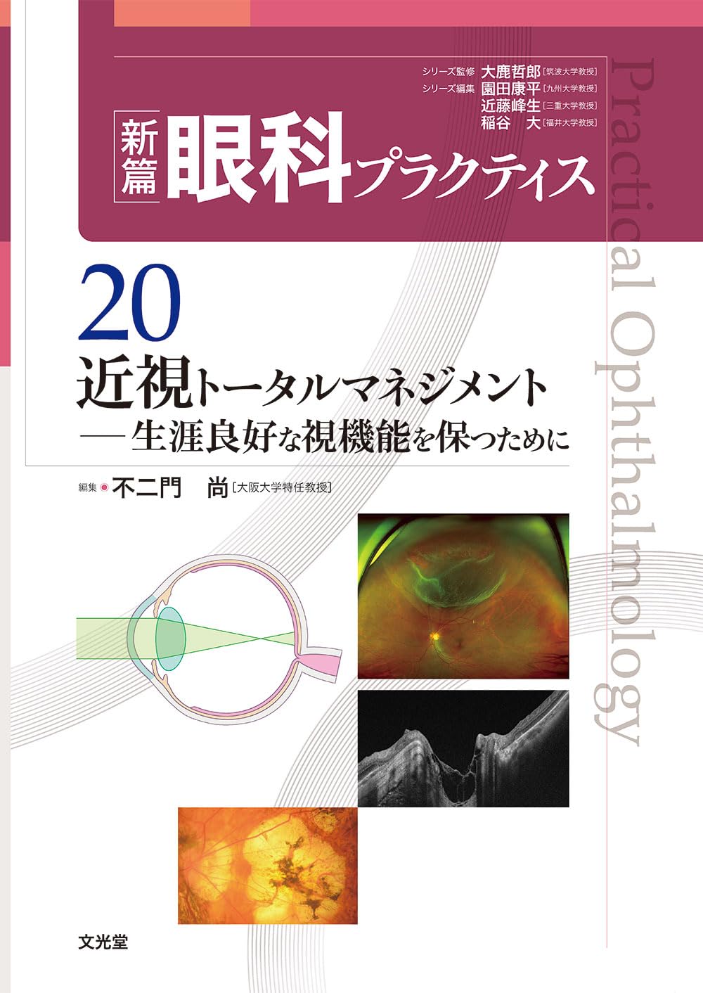 近視トータルマネジメント 生涯良好な視機能を保つために (新篇眼科