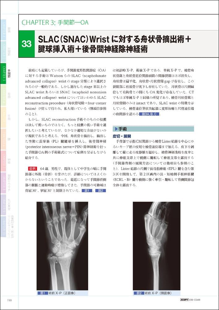 手の外科―私のアプローチ 第3版 | 三浪 明男 |本 | 通販 | Amazon