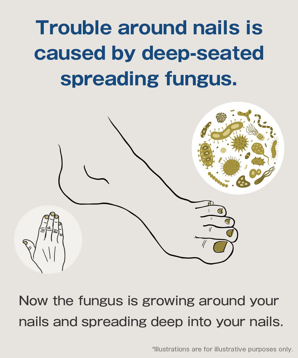 Amazon.co.jp: Medicated Gel That Penetrates Into Your Nails and