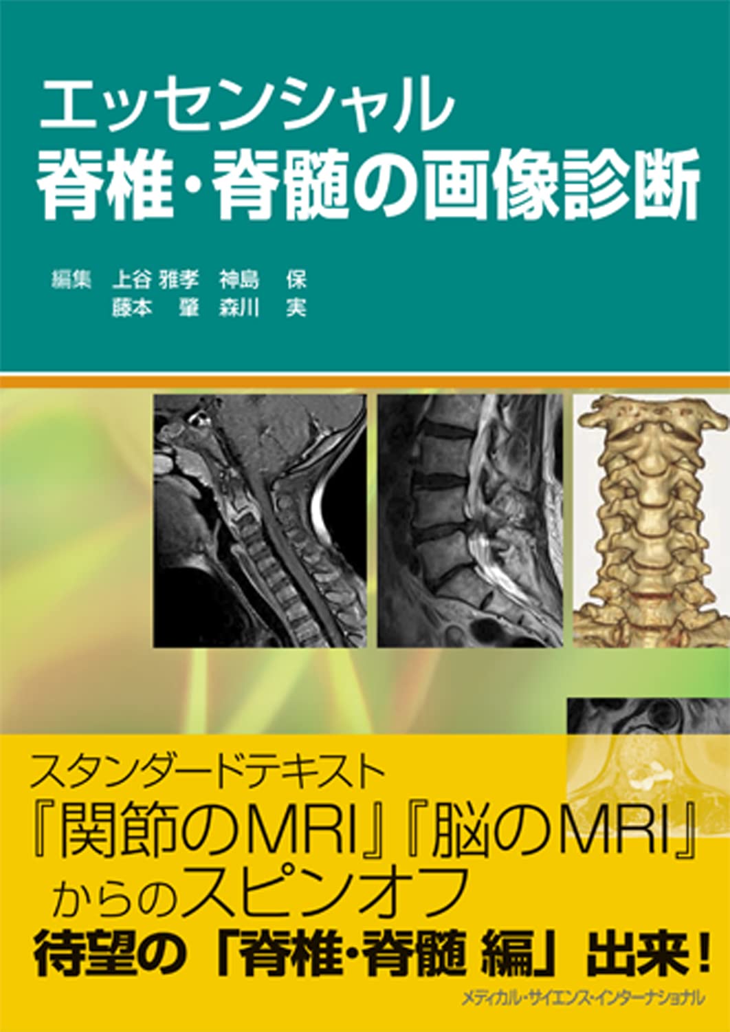 裁断済み】エキスパートのための脊椎脊髄疾患のMRI 第3版 裁断済】