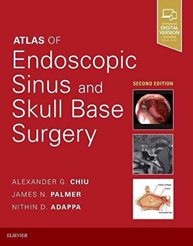 Atlas of Endoscopic Sinus and Skull Base Surgery: 9780323476645