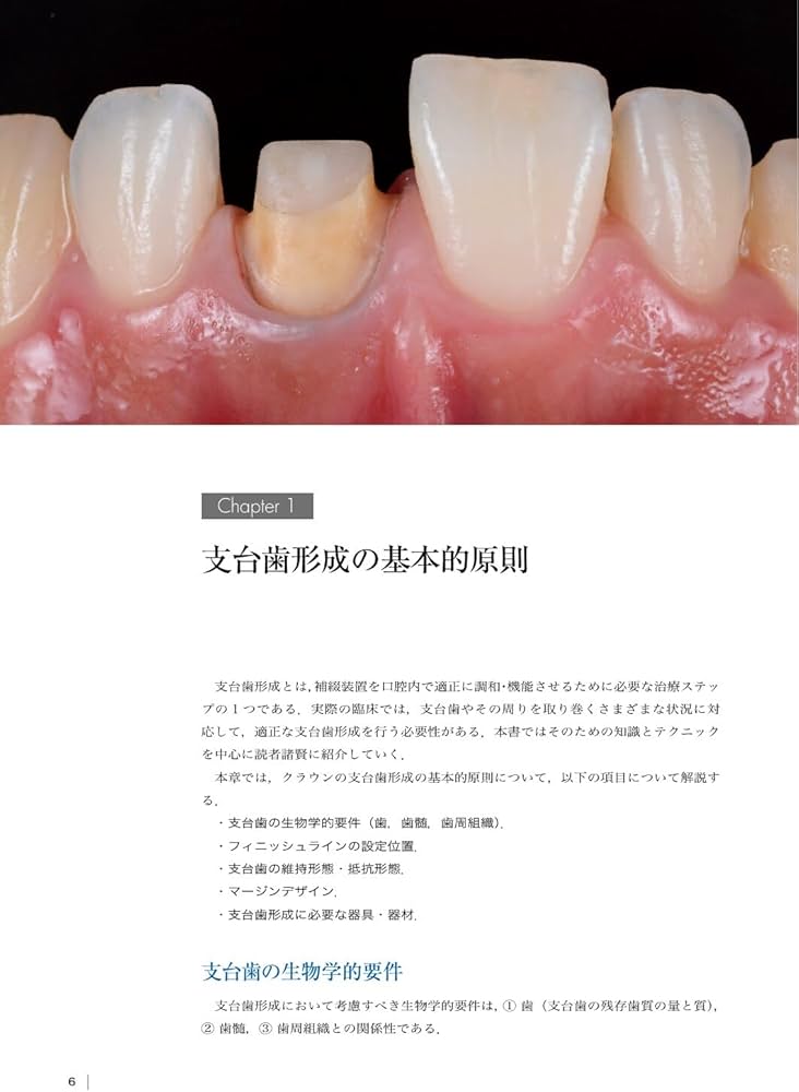 The Tooth Preparation: 補綴修復治療の成功を目指した支台歯形成