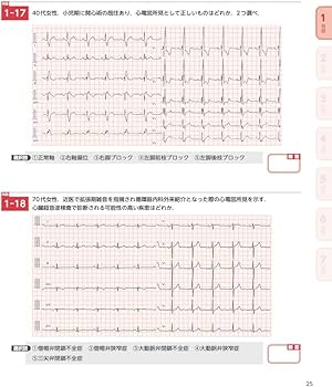 心電図7日間最強ブースト マイスターと鍛える1・2級合格へのテーマ別