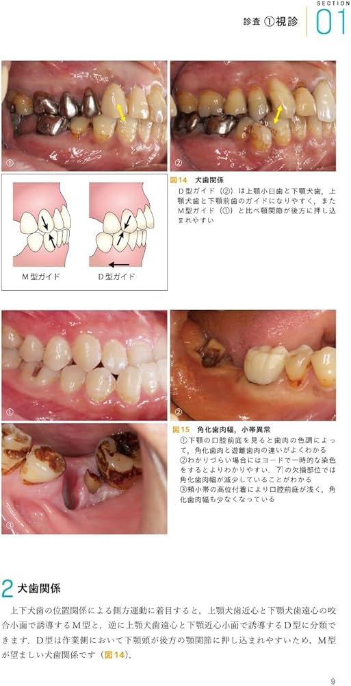 Ishiyaku the BASICS 新ベーシックペリオ: ここからはじめる歯周治療の