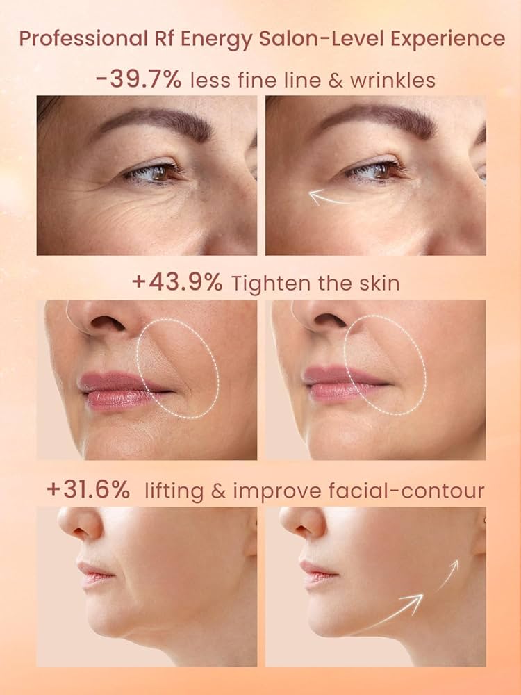 Amazon.com: RF Radio Frequency Facial Device, 1MHz RF Machine for