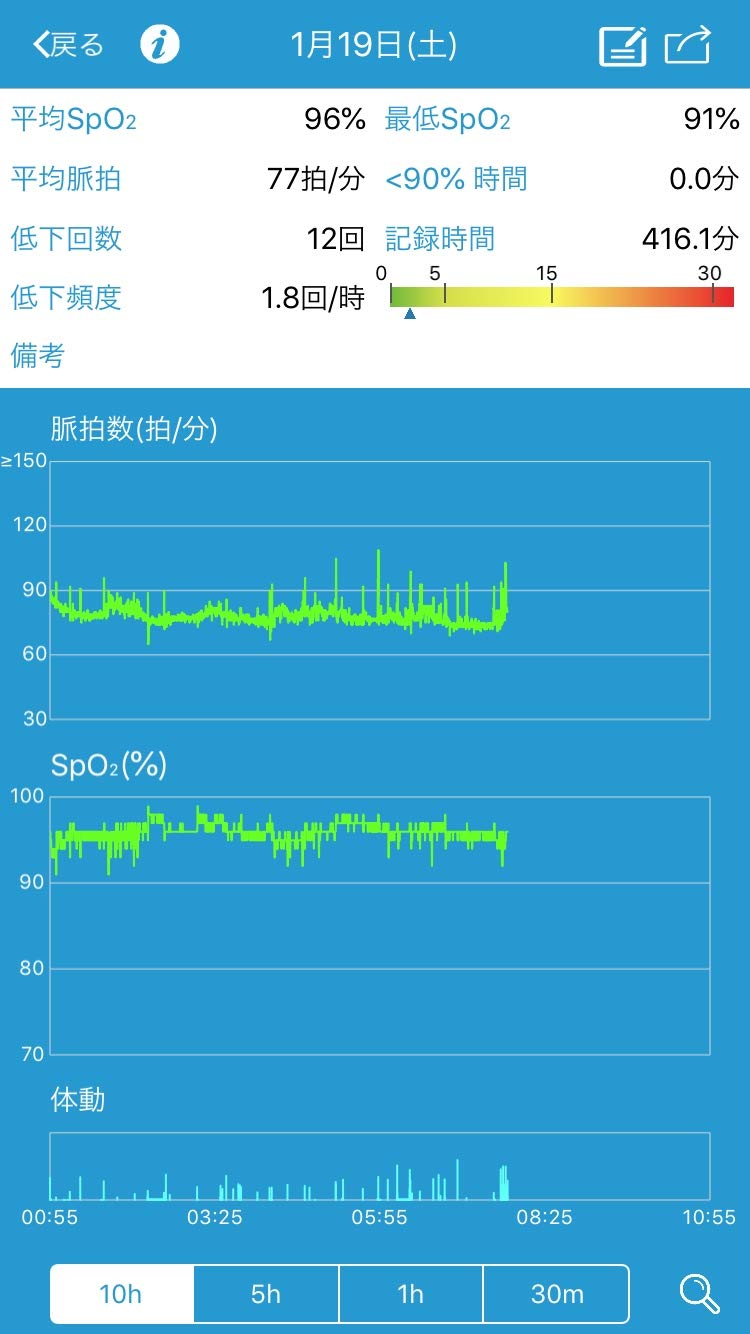 Amazon | リングO2（リングオーツー） 長時間用パルスオキシメータ