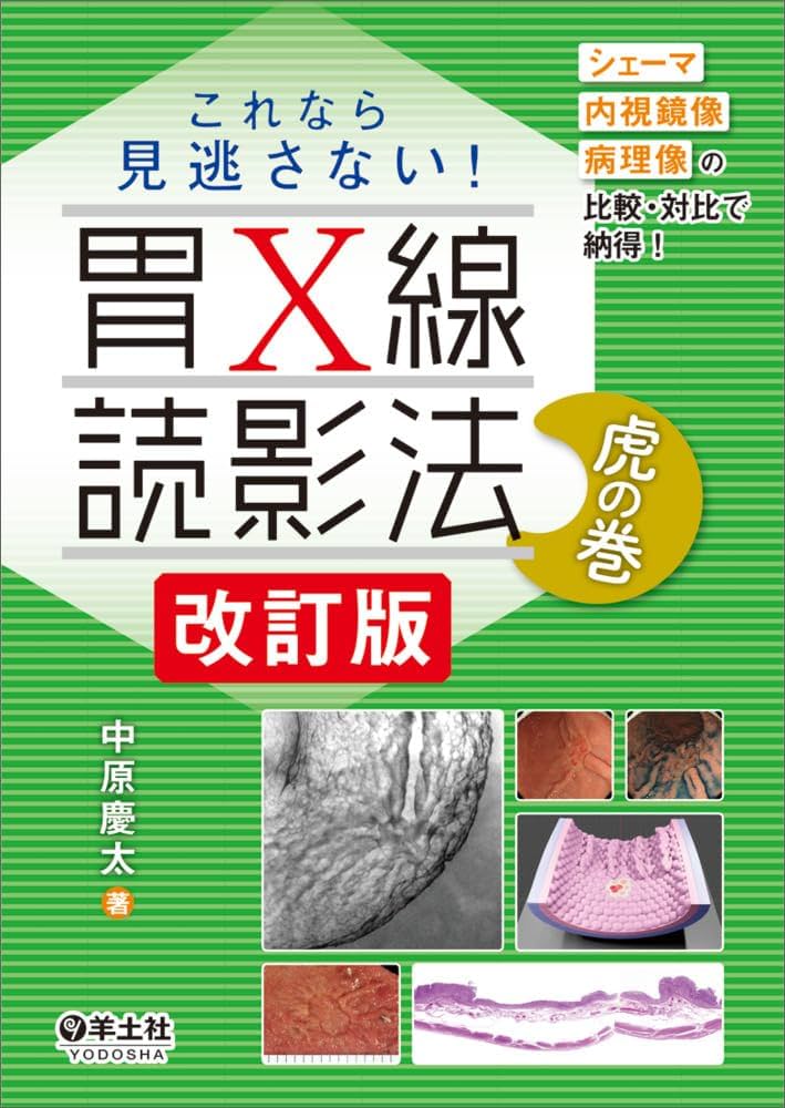 これなら見逃さない！胃X線読影法 虎の巻 改訂版〜シェーマ＋内視鏡像