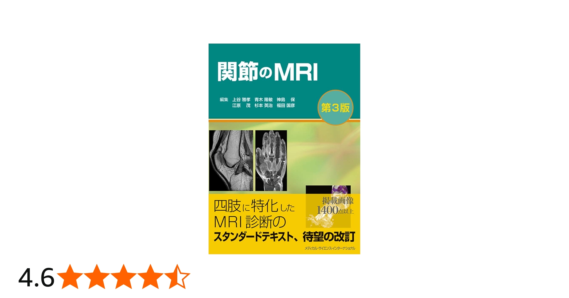 関節のMRI 第3版 | 上谷雅孝, 青木隆敏, 神島 保, 江原 茂, 杉本英治