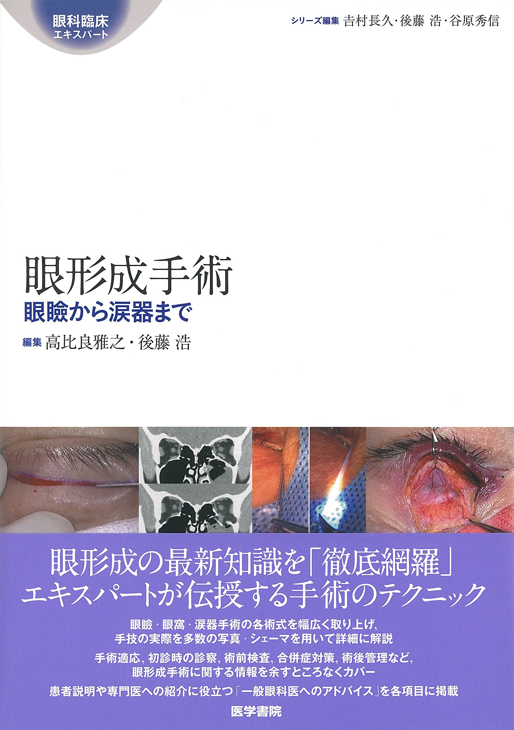 Amazon.co.jp: 眼形成手術: 眼瞼から涙器まで (眼科臨床エキスパート