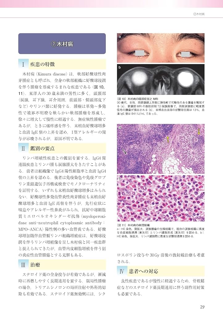 眼科診療ガイド 第2版 | 根木 昭 |本 | 通販 | Amazon