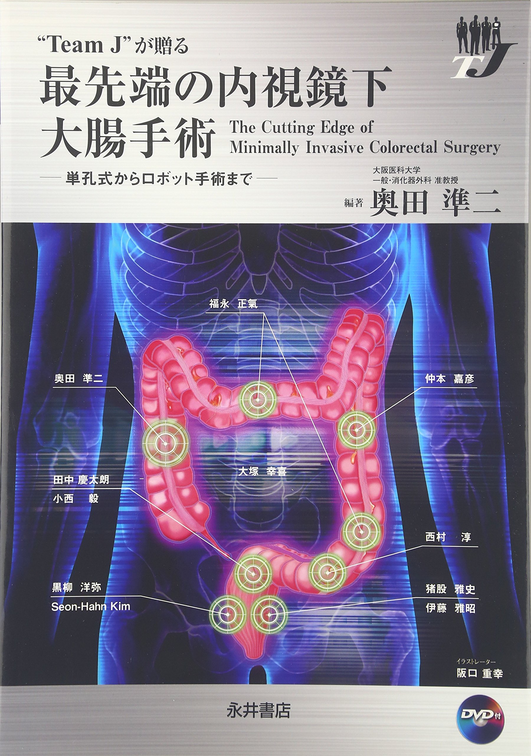 Team J”が贈る最先端の内視鏡下大腸手術: 単孔式からロボット手術まで