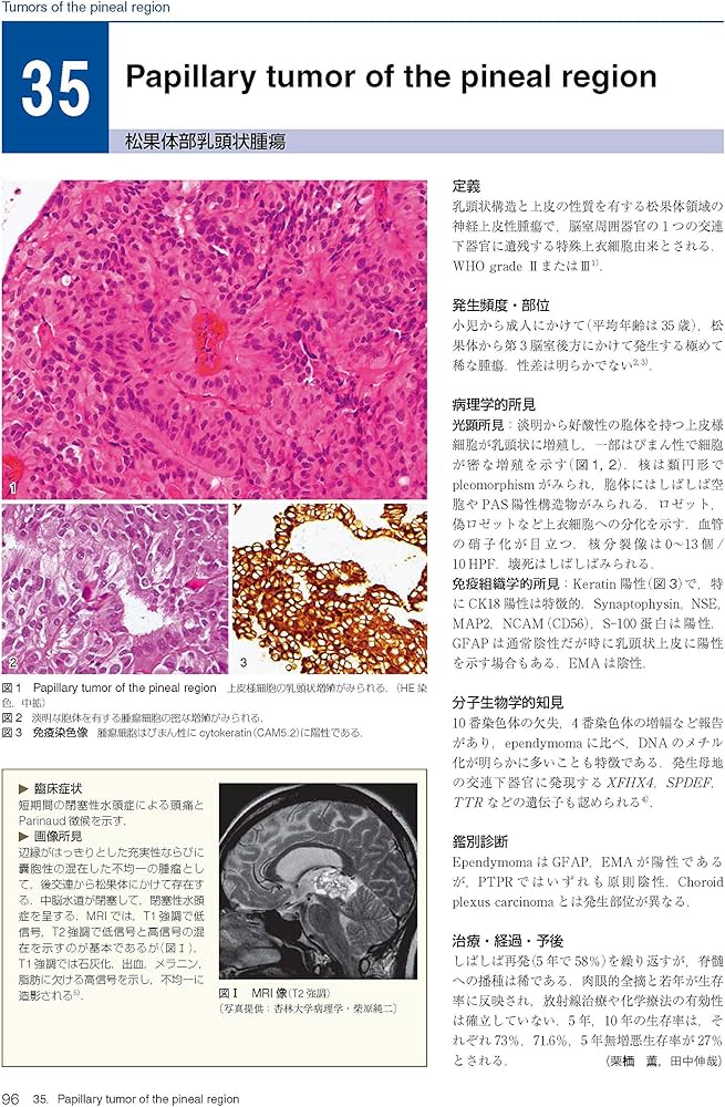 脳腫瘍臨床病理カラーアトラス 第4版 | 日本脳腫瘍病理学会, 若林俊彦