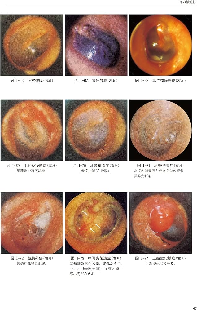 新耳鼻咽喉科学 | 野村 恭也, 加我 君孝, 切替 一郎 |本 | 通販 | Amazon