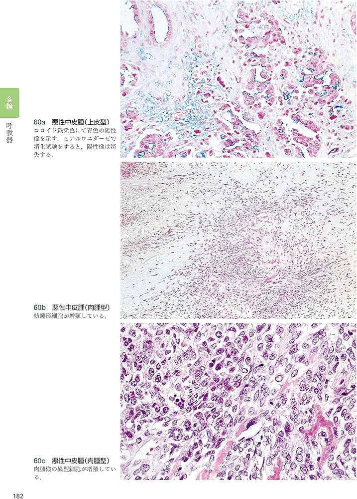 組織病理カラーアトラス[Web付録付] 第3版 | 坂本 穆彦 |本 | 通販