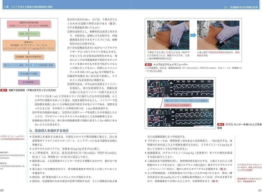 麻酔科医のためのリスクを有する患者の周術期管理 (新戦略に基づく麻酔