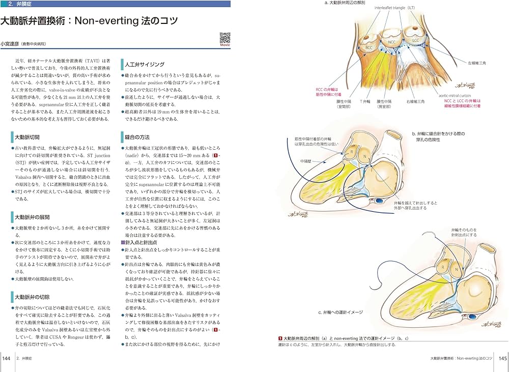 816vhFuKqzL._AC_UF1000,