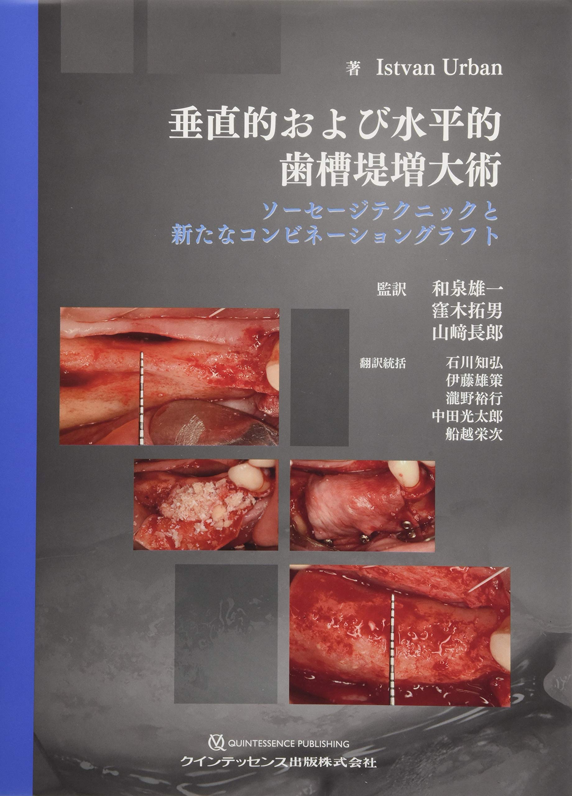 Amazon.co.jp: 垂直的および水平的歯槽堤増大術: ソーセージテクニック