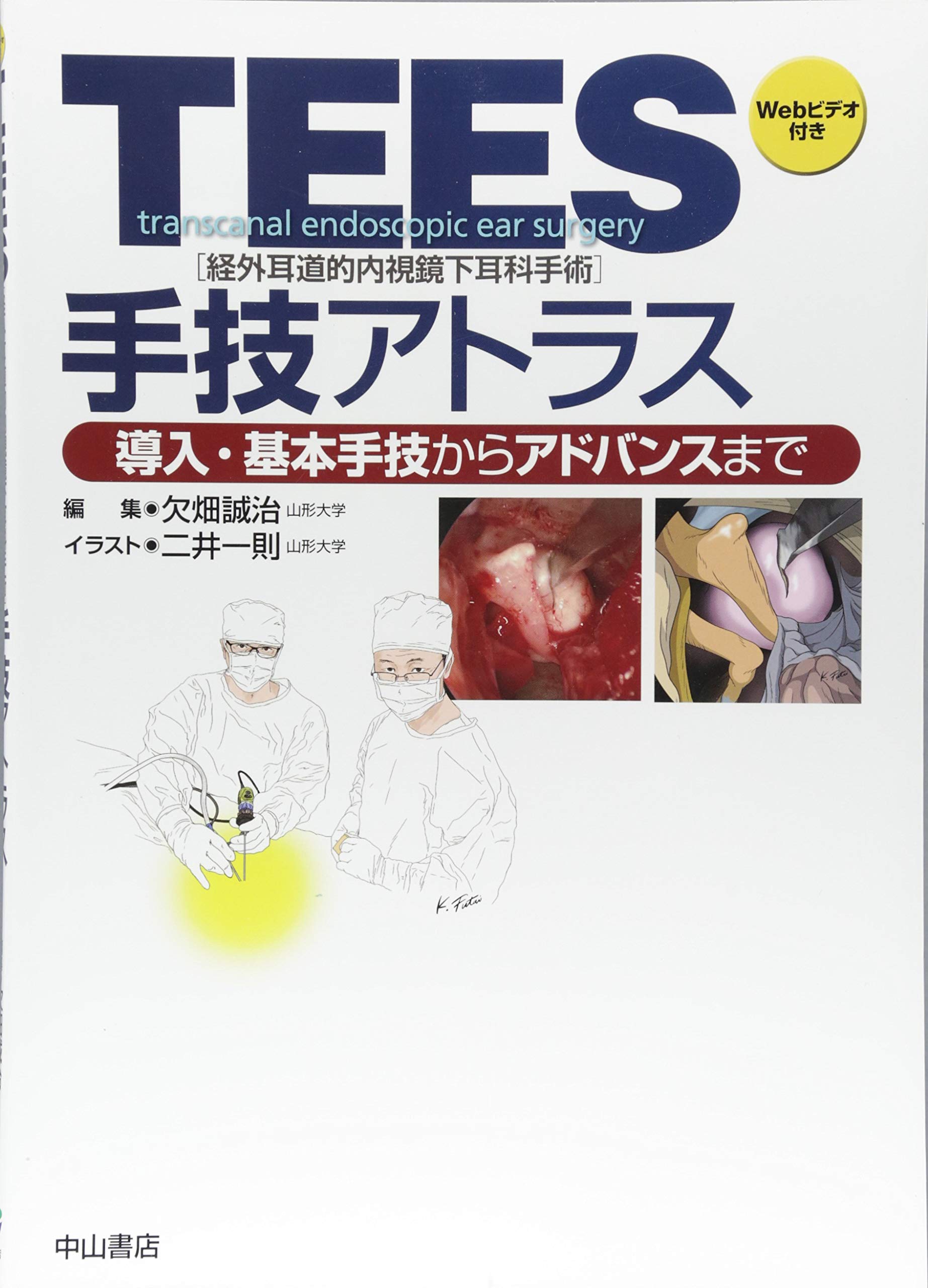 TEES(経外耳道的内視鏡下耳科手術)手技アトラス | 欠畑誠治, 二井一則