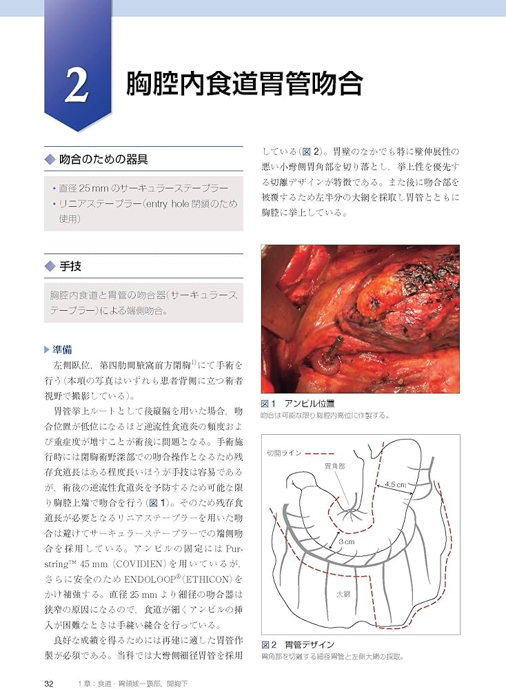 消化管吻合法バイブル [Web動画付] | 北島 政樹 |本 | 通販 | Amazon
