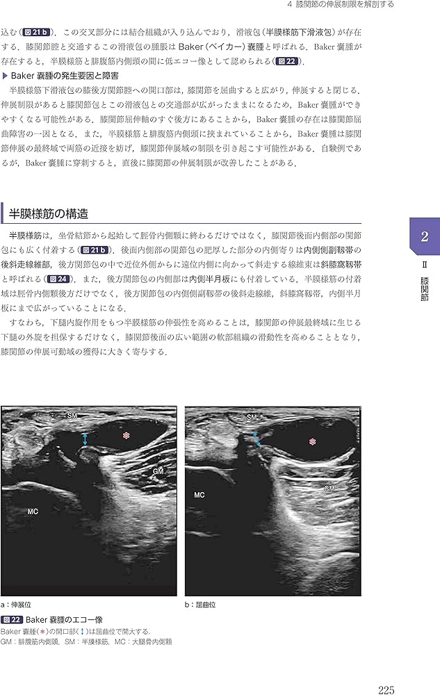 運動療法その前に! 運動器の臨床解剖アトラス | 北村清一郎, 工藤