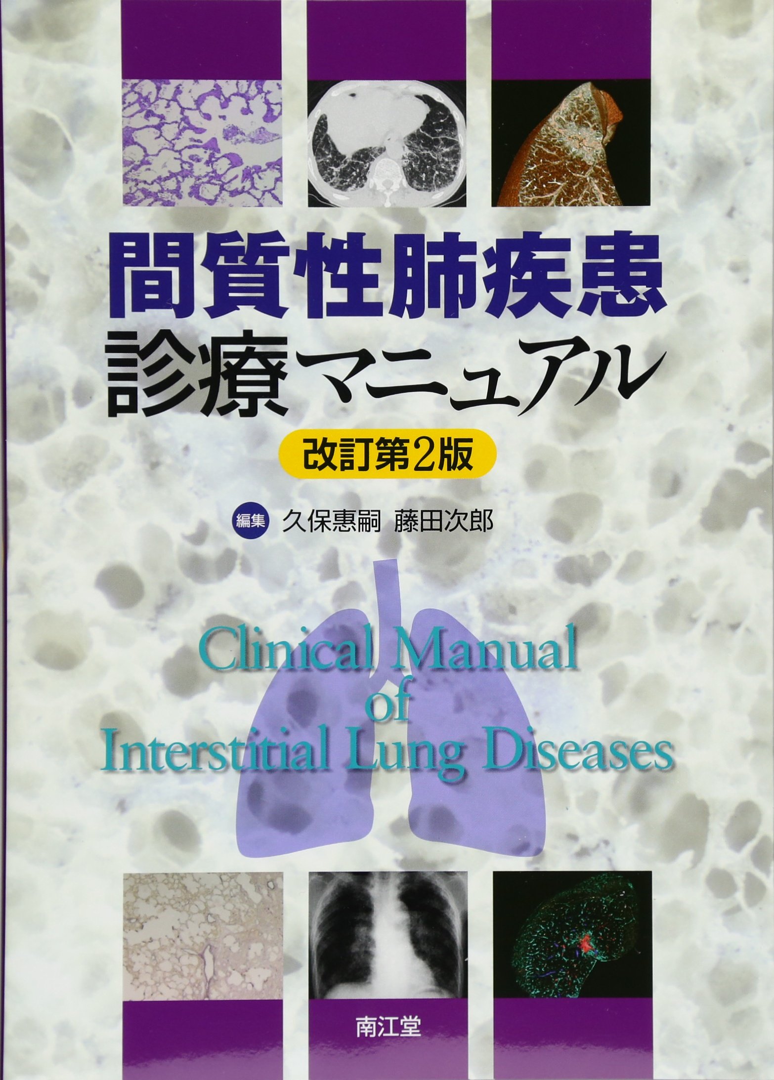 Amazon.co.jp: 間質性肺疾患診療マニュアル 改訂第2版 : 久保 惠嗣