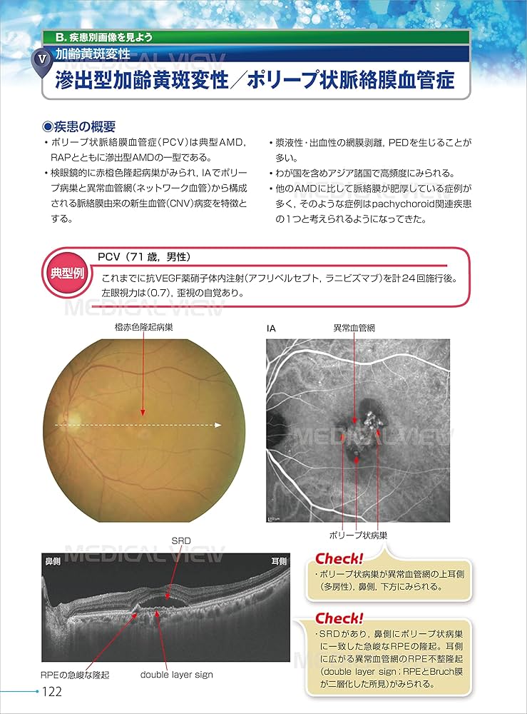 新OCT・OCTA読影トレーニング | 白神 史雄, 飯田 知弘 |本 | 通販 | Amazon