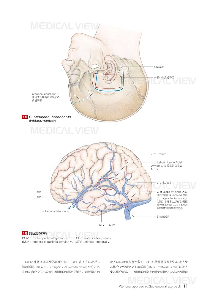 Amazon.co.jp: 新 脳神経外科手術のための解剖学 : 塩川 芳昭, 斉藤 延