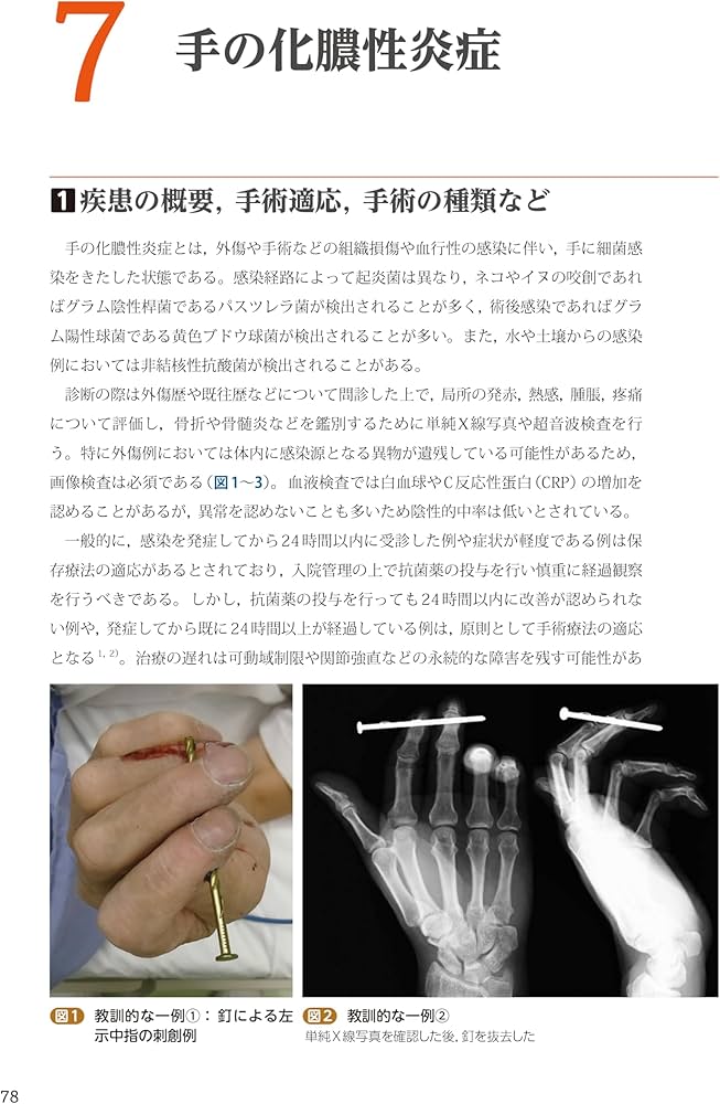 手外科手術ノート part3：外傷以外の主要疾患治療編 | 大井宏之 |本