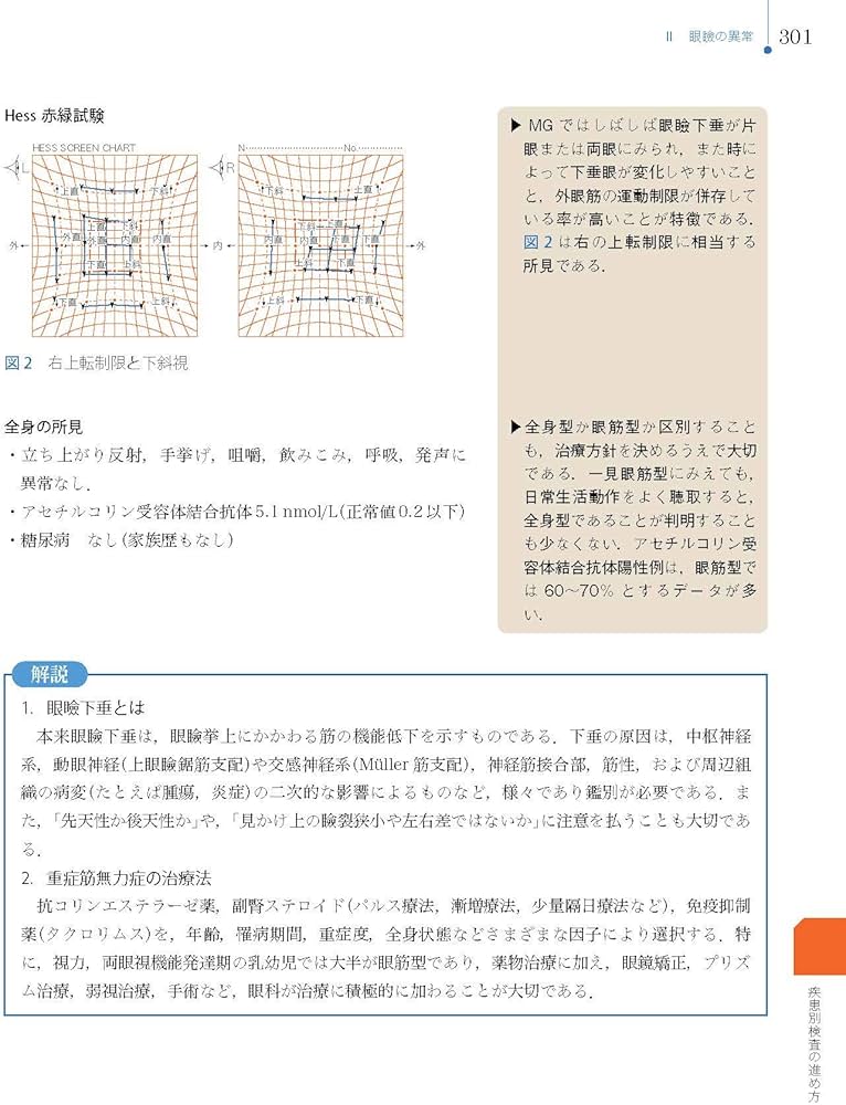 Amazon.co.jp: 視能検査学 (視能学エキスパート) : 公益社団法人 日本