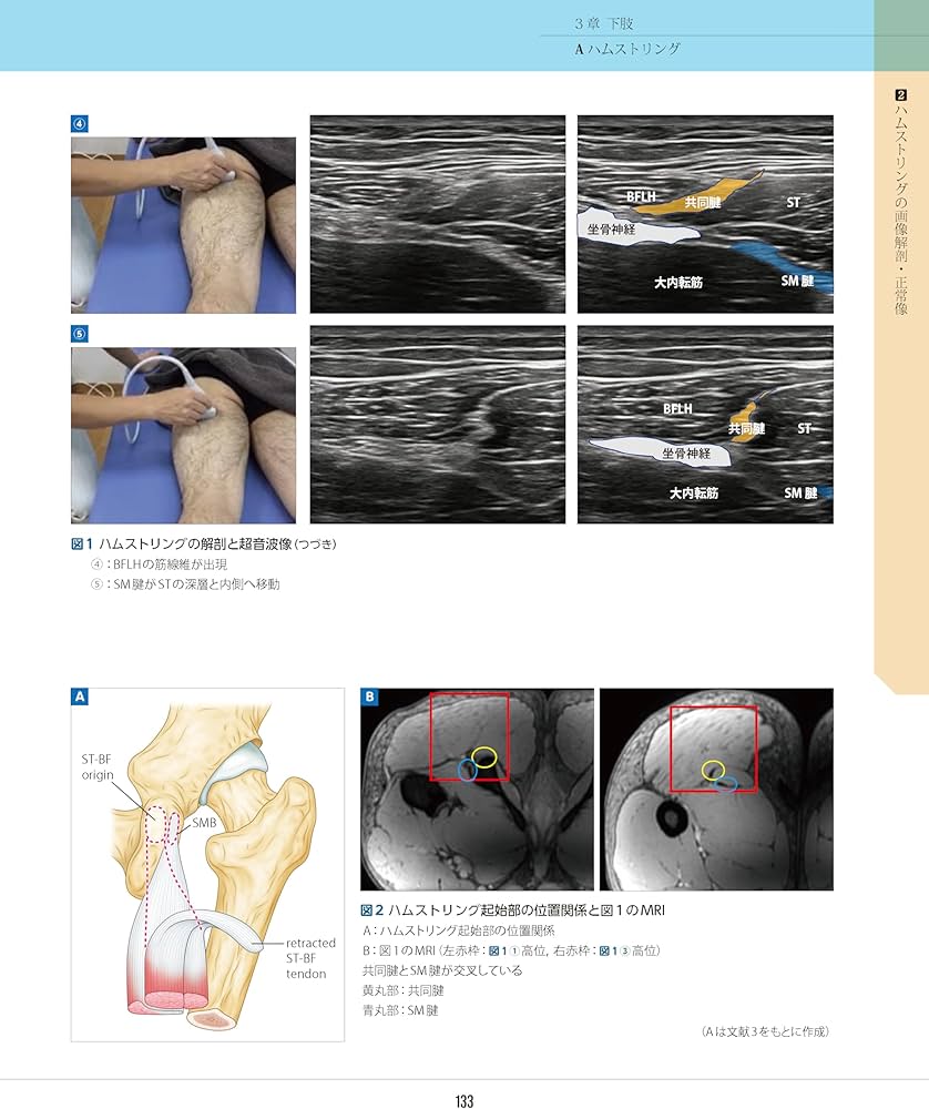スポーツ障害〉筋損傷のエコー活用術 ―電子版付― | 和田 誠, 熊井 司