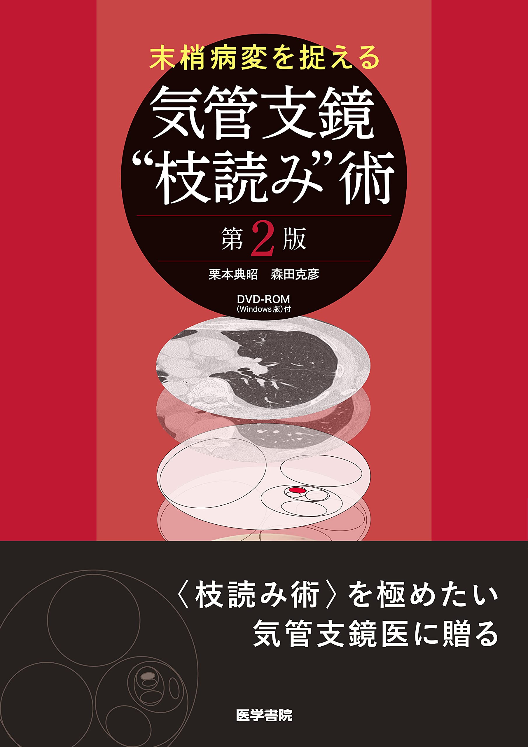 末梢病変を捉える 気管支鏡“枝読み”術 [DVD-ROM(Windows版)付] 第2版