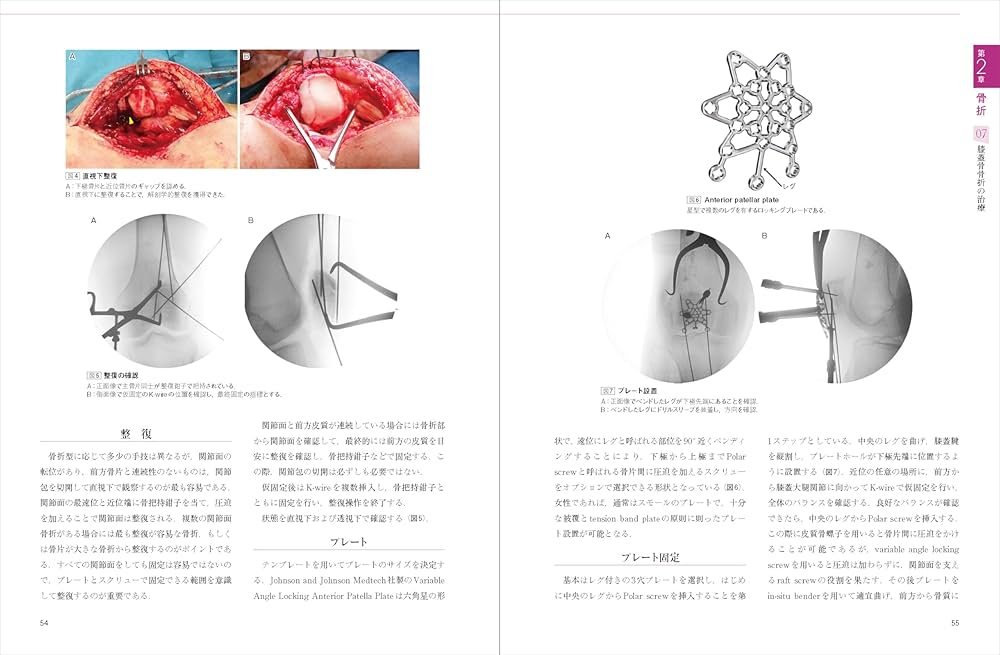膝の外傷：診断・適応・手術 (整形外科SURGICAL TECHNIQUE BOOKS 14