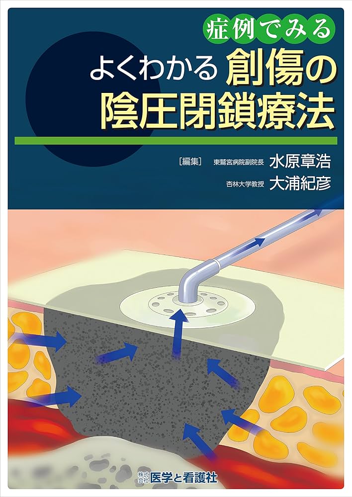 症例でみるよくわかる創傷の陰圧閉鎖療法 | 水原 章浩, 大浦 紀彦 |本