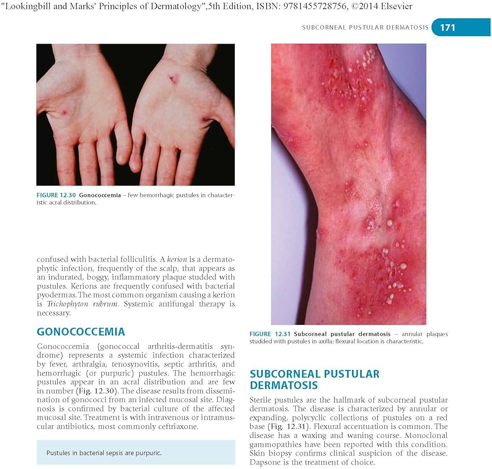 81adaB-UD2L._AC_UF1000,