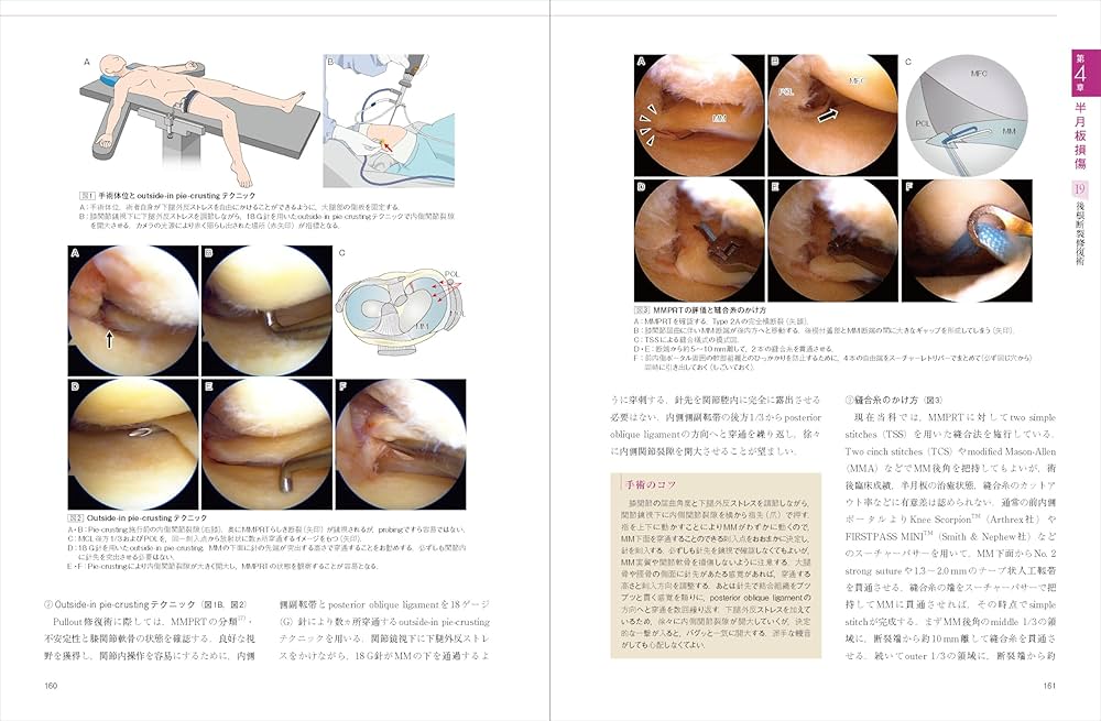 膝の外傷：診断・適応・手術 (整形外科SURGICAL TECHNIQUE BOOKS 14