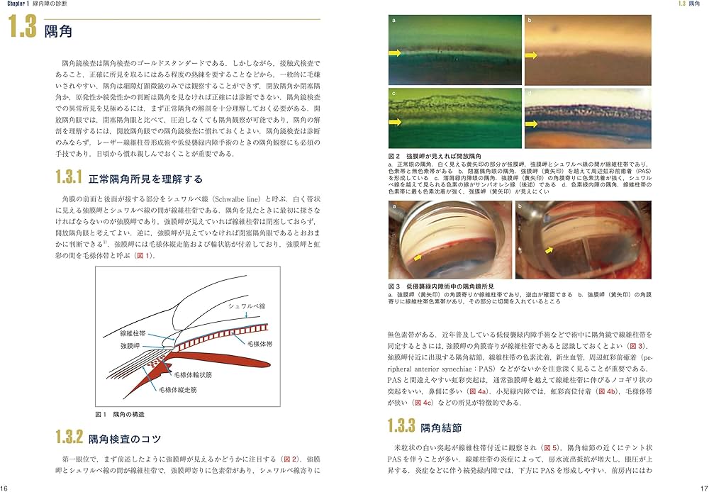 最新 緑内障診療パーフェクトガイドー患者教育から最新の手術治療まで