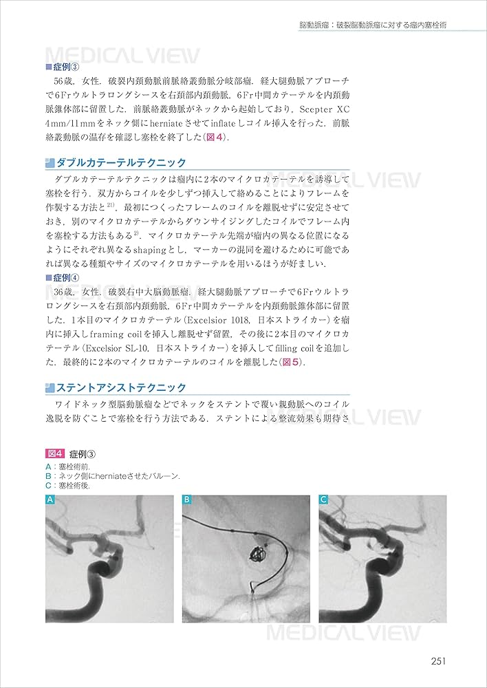 パーフェクトマスター脳血管内治療−第3版 | 滝 和郎, 中原 一郎, 太田