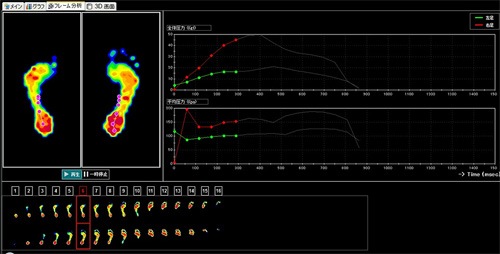 TRUEfeet（トゥルーフィート）足裏バランス・姿勢補正サポート｜足指