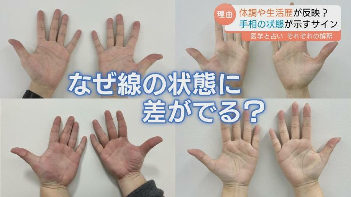 手相が変わる」ってホント？ 運勢をみるだけじゃない！手相が示す健康
