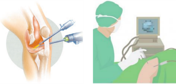 ひざ関節の主な診療疾患と専門的治療|医療法人伯鳳会 大阪中央病院