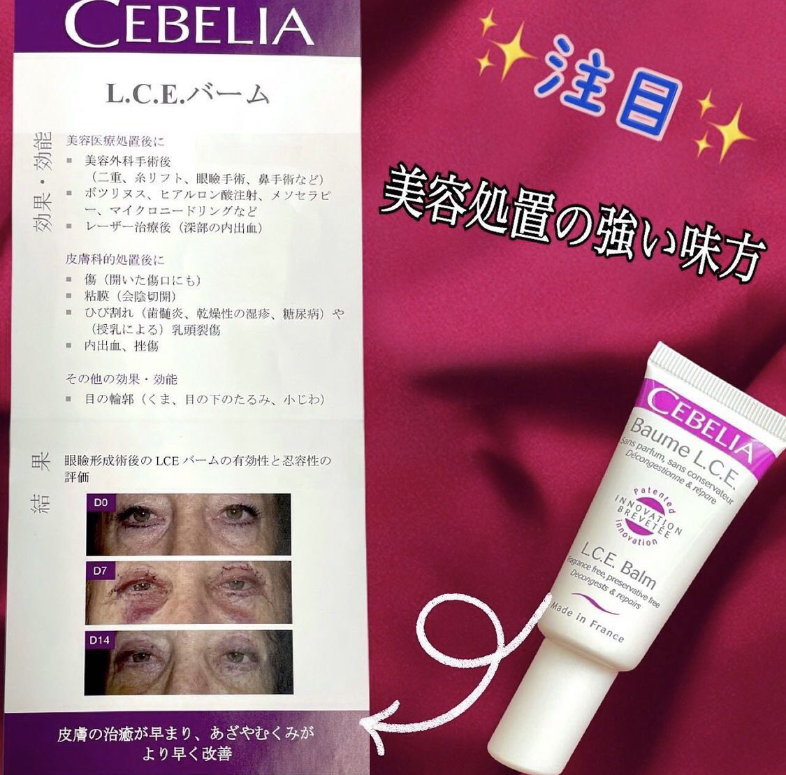 CEBELIA 保湿ケアバーム 2箱 【公式通販】