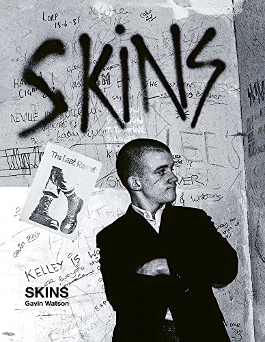 Skins: Gavin Watson by Gavin Watson: New (2023) | Kennys Bookshop