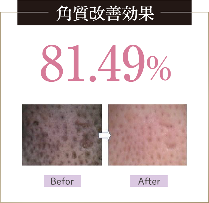 platinum plapeel（プラピール）