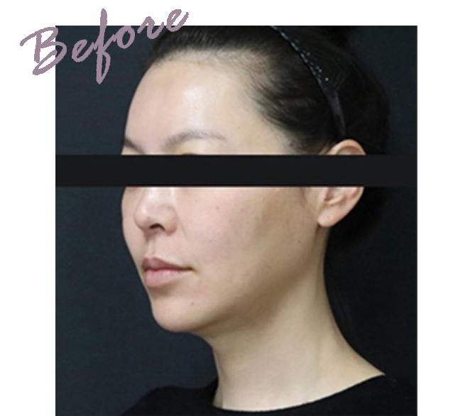 platinum plapeel（プラピール）